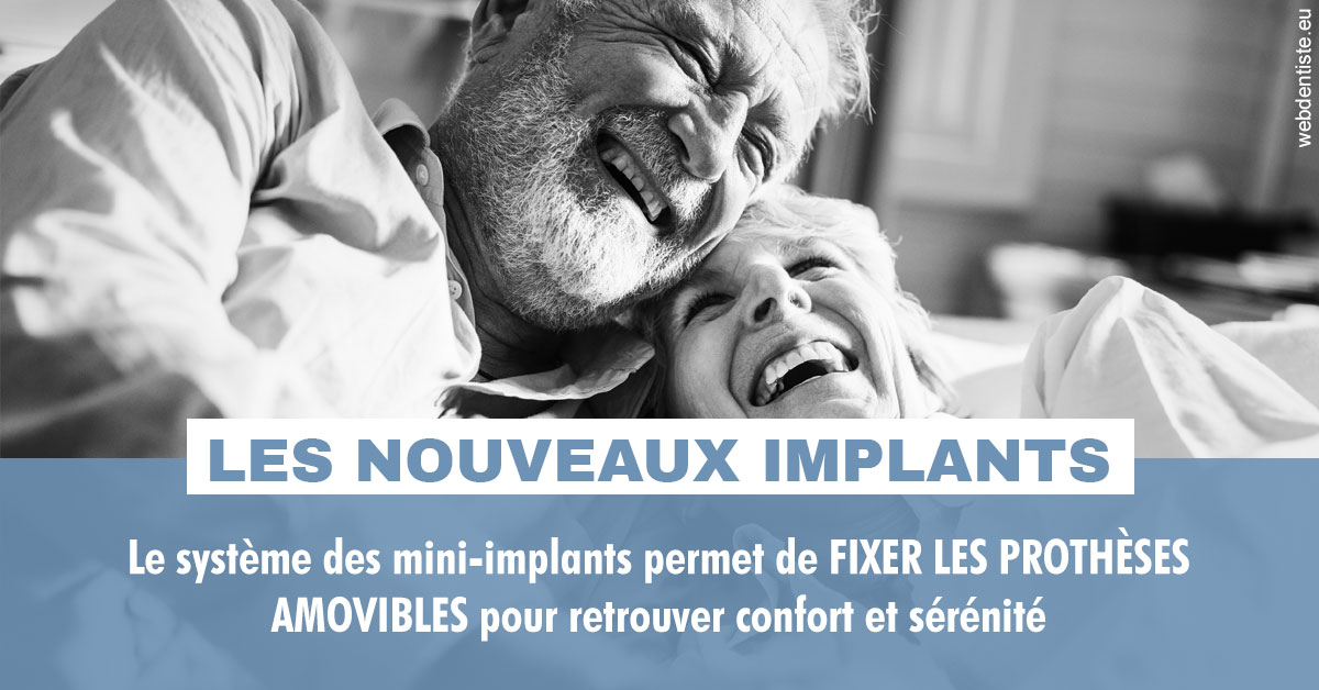 https://dr-vincent-maire.chirurgiens-dentistes.fr/Les nouveaux implants 2