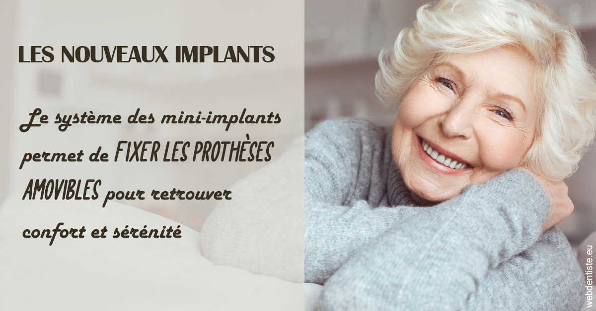 https://dr-vincent-maire.chirurgiens-dentistes.fr/Les nouveaux implants 1