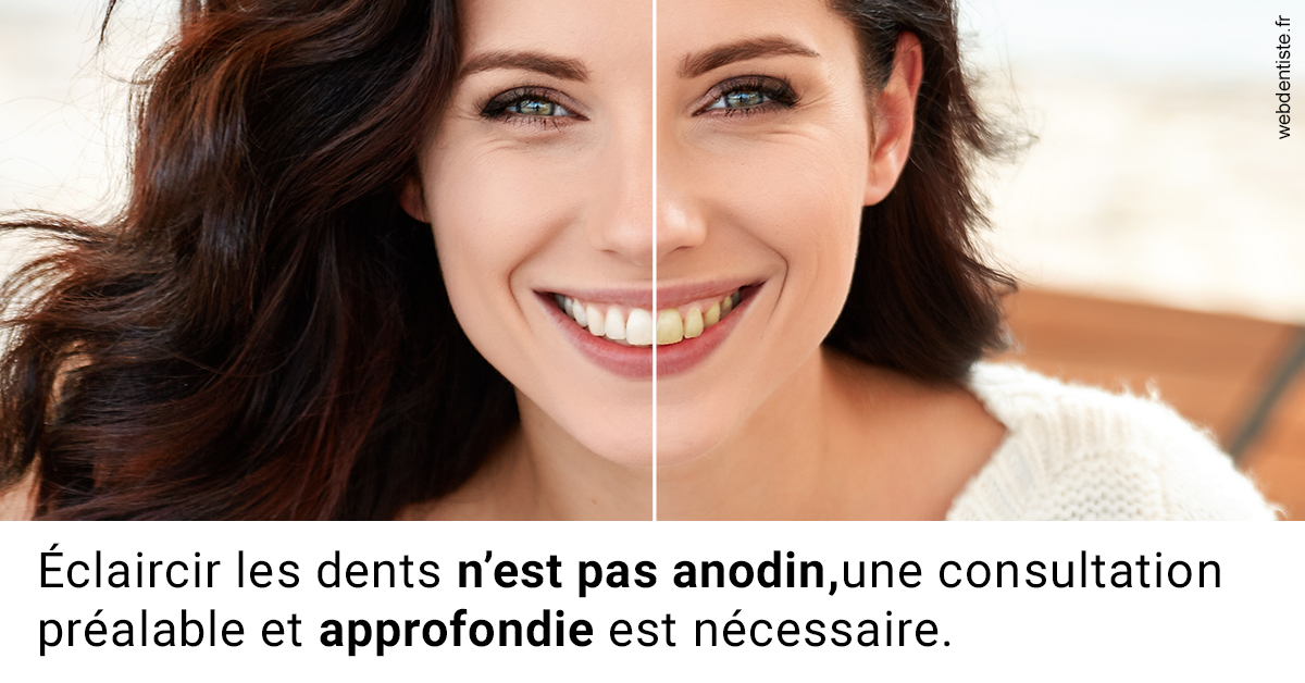 https://dr-vincent-maire.chirurgiens-dentistes.fr/Le blanchiment 2