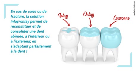 https://dr-vincent-maire.chirurgiens-dentistes.fr/L'INLAY ou l'ONLAY