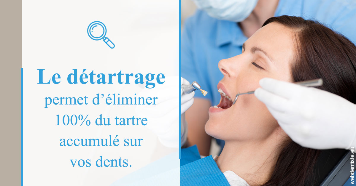 https://dr-vincent-maire.chirurgiens-dentistes.fr/En quoi consiste le détartrage
