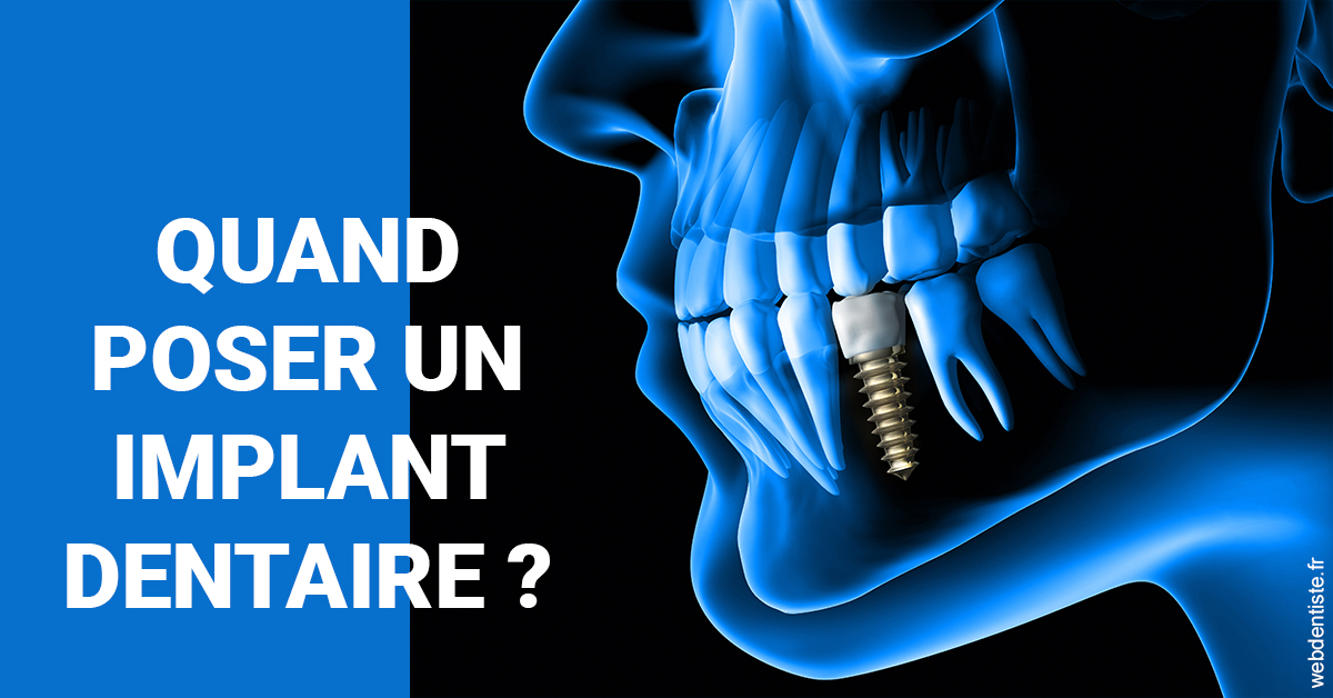 https://dr-vincent-maire.chirurgiens-dentistes.fr/Les implants 1