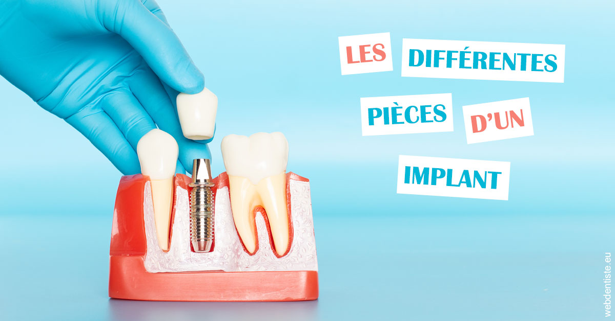 https://dr-vincent-maire.chirurgiens-dentistes.fr/Les différentes pièces d’un implant 2