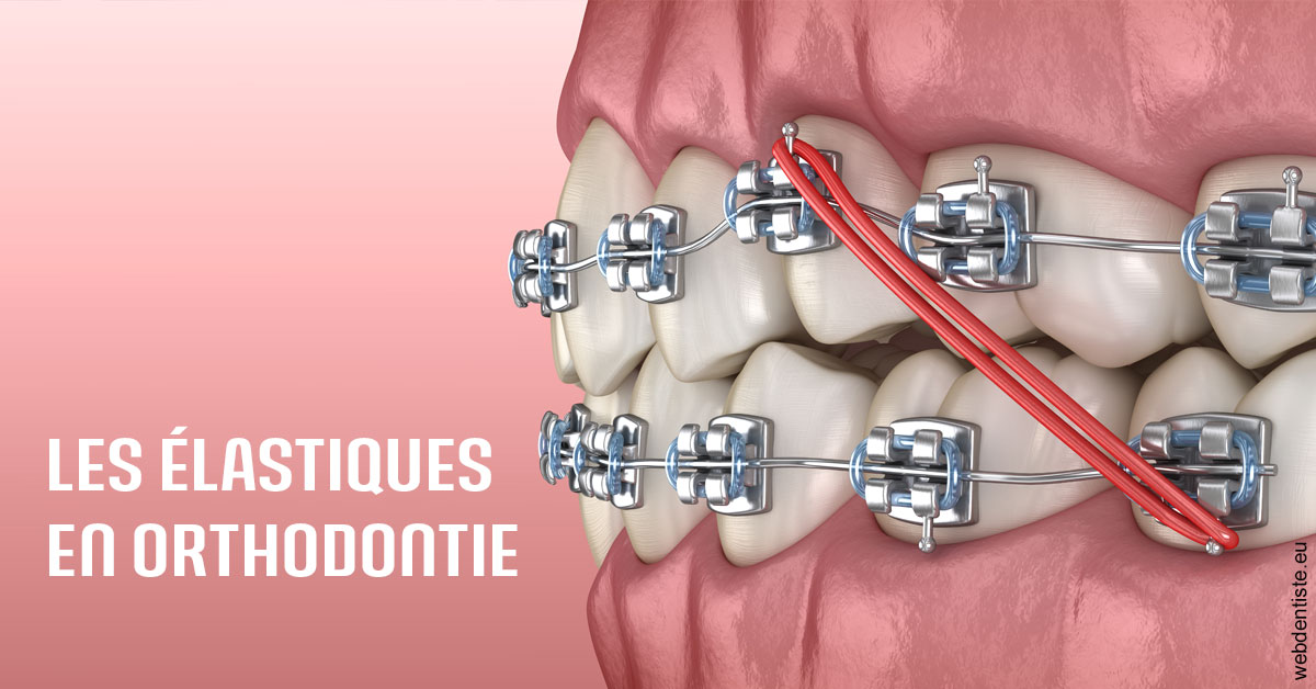 https://dr-vincent-maire.chirurgiens-dentistes.fr/Elastiques orthodontie 2