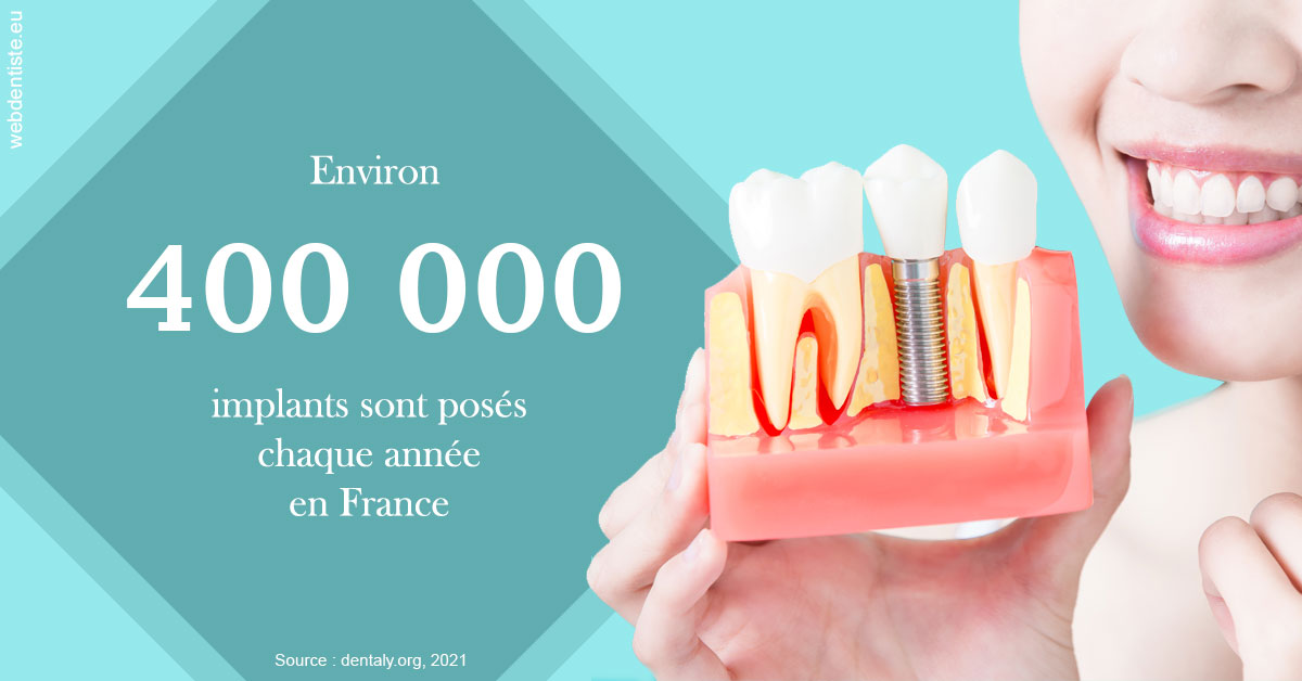 https://dr-vincent-maire.chirurgiens-dentistes.fr/Pose d'implants en France 2